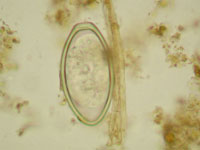 immature oxyuris(pinworm)