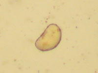 mature oxyirus(pinworm)
