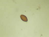 trichuris(whipworm)
