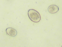 eimeria(coccidia)