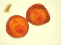 moniezia(tapeworm)